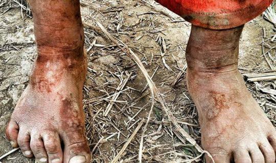 cover "Backpack Hiking Trip to Visit Our Younger Siblings" March 5-6, 2016 (Special Education Room, Ban Laiwo Branch, Ban Kong Mong Tha School)