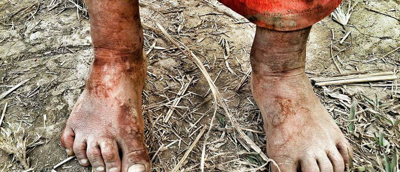 cover "ทริปแบกเป้ เดินป่า ไปหาน้อง" 5-6 มีนาคม 2559 (ห้องเรียพิเศษสาขาบ้านไล่โว่ โรงเรียนบ้านกองม่องทะ)